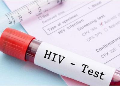 185 نفر در چهارمحال و بختیاری به ویروس HIV مبتلا هستند